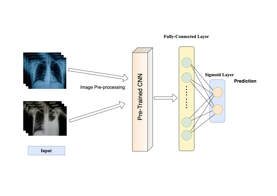 Understanding Transfer Learning: Benefits and Practical Applications in Pneumonia Detection